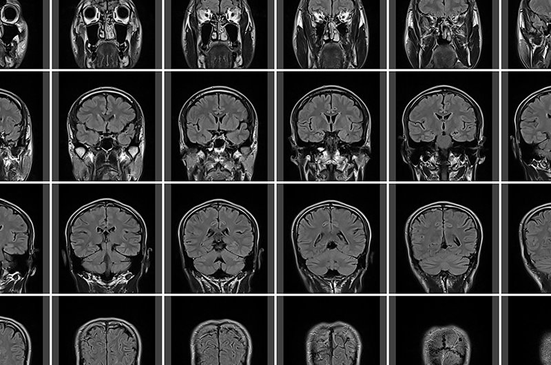 身体の断面図を撮影する検査